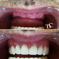 BLERINA DENT Vollga - Dr. Blerina Bani Topra - Dentist Durres ,Albania Pro Implants & Aesthetic Dentistry