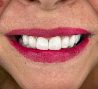 BLERINA DENT Vollga - Dr. Blerina Bani Topra - Dentist Durres ,Albania Pro Implants & Aesthetic Dentistry
