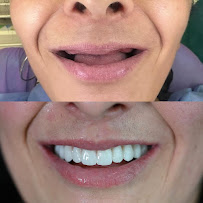 BLERINA DENT Vollga - Dr. Blerina Bani Topra - Dentist Durres ,Albania Pro Implants & Aesthetic Dentistry