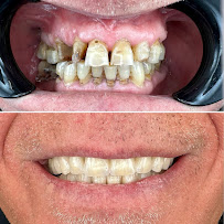 BLERINA DENT Vollga - Dr. Blerina Bani Topra - Dentist Durres ,Albania Pro Implants & Aesthetic Dentistry