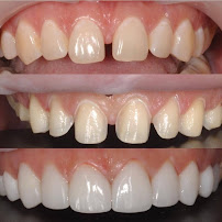 TIVARI DENTAL & AESTHETIC