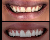 TIVARI DENTAL & AESTHETIC
