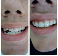 TIVARI DENTAL & AESTHETIC