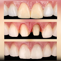 TIVARI DENTAL & AESTHETIC