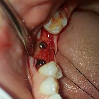 TIVARI DENTAL & AESTHETIC