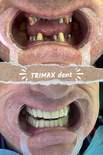 TRIMAX DENT