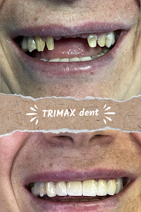 TRIMAX DENT