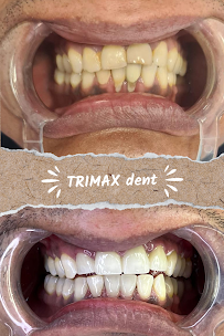 TRIMAX DENT