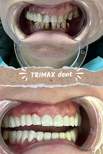 TRIMAX DENT