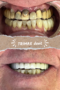 TRIMAX DENT