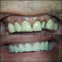 Ohana Dent