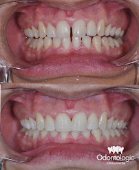 Odontologic Clínica Dental - NÁPOLES