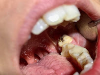 Dr. Lászlófy Csaba implantológus és szájsebész BUDAPEST