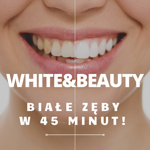 Laserowe Wybielanie Zębów White Beauty w Krakowie - dental clinic in Krakow, Poland
