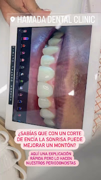 Hamada Dental Clinic | Clínica Dental & Odontólogo en Santo Domingo
