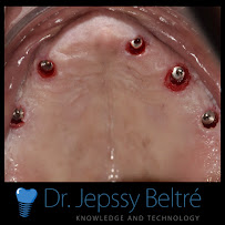 Dr. Jepssy Beltré