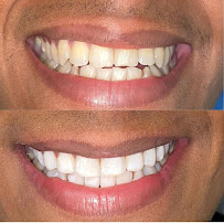 Dra. Sabrinsky Flores | Clínica Dental y Estética
