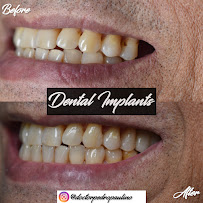 Dr. Pedro Paulino - Paulino Almonte Dental Team - Best Dental Services