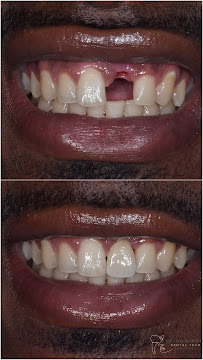 Dr. Pedro Paulino - Paulino Almonte Dental Team - Best Dental Services