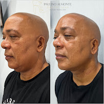 Dr. Pedro Paulino - Paulino Almonte Dental Team - Best Dental Services