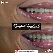 Dr. Pedro Paulino - Paulino Almonte Dental Team - Best Dental Services