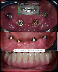 Dr. Pedro Paulino - Paulino Almonte Dental Team - Best Dental Services