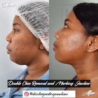 Dr. Pedro Paulino - Paulino Almonte Dental Team - Best Dental Services