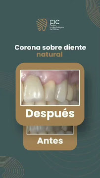 Centro Implantológico del Cibao