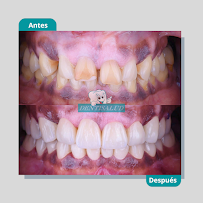 DENTISALUD