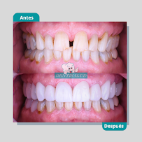 DENTISALUD