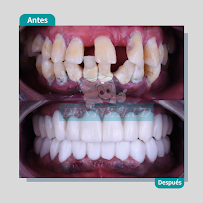DENTISALUD