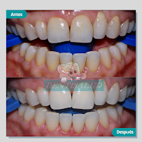DENTISALUD