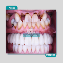 DENTISALUD