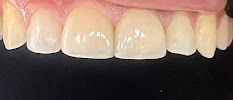Dentística Odontología Especializada - Dra. Jenny Domínguez