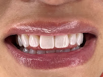 Dentística Odontología Especializada - Dra. Jenny Domínguez