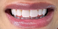 Dentística Odontología Especializada - Dra. Jenny Domínguez