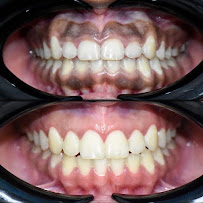 Dentística Odontología Especializada - Dra. Jenny Domínguez