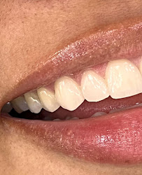 Dentística Odontología Especializada - Dra. Jenny Domínguez