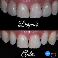 Dentística Odontología Especializada - Dra. Jenny Domínguez