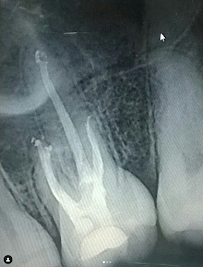 Dentística Odontología Especializada - Dra. Jenny Domínguez