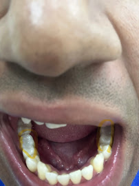 Dentfix - Colinas Mall