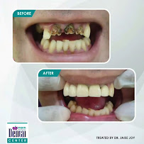 Dr.Jaise Joy Dental Surgeon