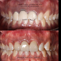 Clínica dental FRANCA SONRISA/Diseño de sonrisa/Resinas/Muelas del juicio/Brackets/Alineadores/odontopediatria/