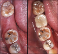 Clínica dental FRANCA SONRISA/Diseño de sonrisa/Resinas/Muelas del juicio/Brackets/Alineadores/odontopediatria/