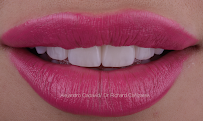 Dental Esthetic Solutions Puerto Rico Dr. Richard Canizares , Dra. Marlene Rivera