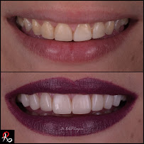 Dental Esthetic Solutions Puerto Rico Dr. Richard Canizares , Dra. Marlene Rivera