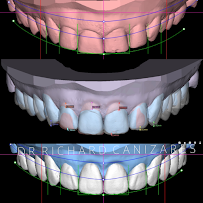 Dental Esthetic Solutions Puerto Rico Dr. Richard Canizares , Dra. Marlene Rivera