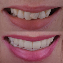 Dental Esthetic Solutions Puerto Rico Dr. Richard Canizares , Dra. Marlene Rivera