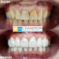 Champion Dental & Ortodoncia