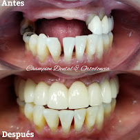 Champion Dental & Ortodoncia